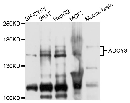 Anti-ADCY3 Antibody