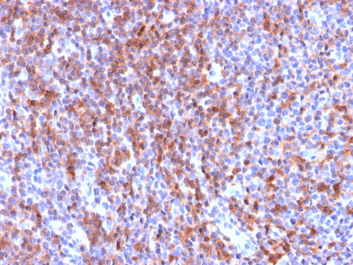 Anti-ICAM3 Antibody [ICAM3/2873R] - BSA and Azide free