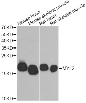 Anti-MYL2 Antibody