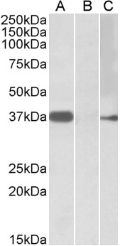 Anti-MYF6 Antibody