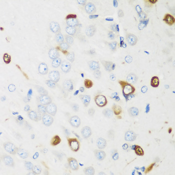 Anti-ELAVL2 Antibody