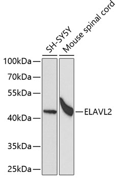 Anti-ELAVL2 Antibody