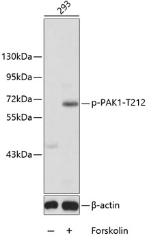 Anti-PAK1 (phospho T212) Antibody