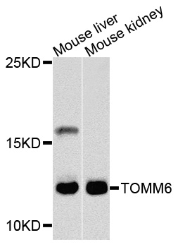 Anti-TOMM6 Antibody