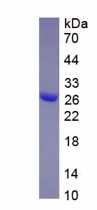 Figure. SDS-PAGE