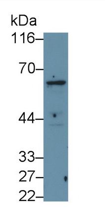 Western Blot; Sample: Recombinant protein.