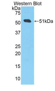 Western Blot; Sample: Recombinant protein.