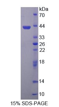 Figure. SDS-PAGE