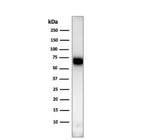 Western blot testing of human Ramos cell lysate with CD86 antibody (clone C86/3713). Expected molecular weight: 38-70 kDa depending on glycosylation level.