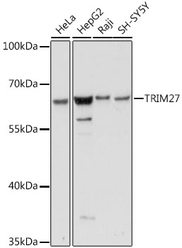 Anti-TRIM27 Antibody