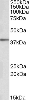 Anti-PRKCDBP Antibody