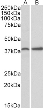 Anti-PRKCDBP Antibody