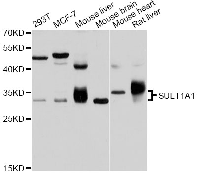 Anti-SULT1A1 Antibody