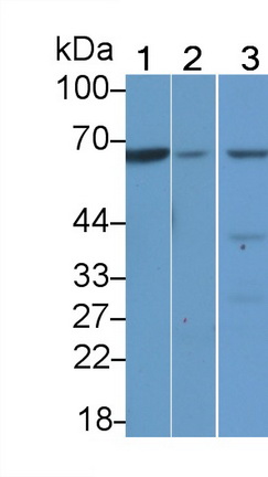 Western Blot; Sample: Lane1: Rat Liver lysate; Lane2: Mouse Liver lysate; Lane3: Mouse Kidney lysate<br/>Primary Ab: 4μg/ml Rabbit Anti-Human TESK1 Antibody<br/>Second Ab: 0.2µg/mL HRP-Linked Caprine Anti-Rabbit IgG Polyclonal Antibody<br/>(Catalog: SAA544Rb19)