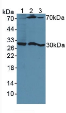 Western Blot; Sample: Lane1: Human Hela Cells; Lane2: Mouse Kidney Tissue; Lane3: Mouse Breast Cancer Tissue.