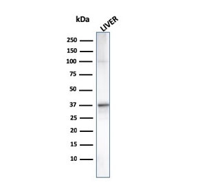 Western blot testing of human liver lysate with C1QA antibody. Predicted molecular weight ~26 kDa.