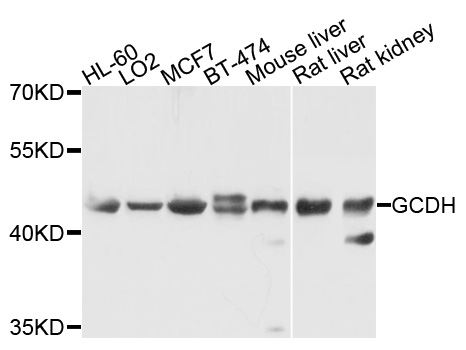 Anti-GCDH Antibody