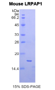 Figure. SDS-PAGE