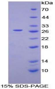 Figure. SDS-PAGE