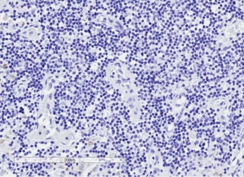 IHC testing of FFPE human lymph node tissue without GLI2 antibody (negative control). HIER: steam section in pH6 citrate buffer for 20 min.