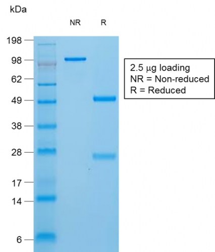 Anti-Thyroglobulin Antibody [TGB/1970R]