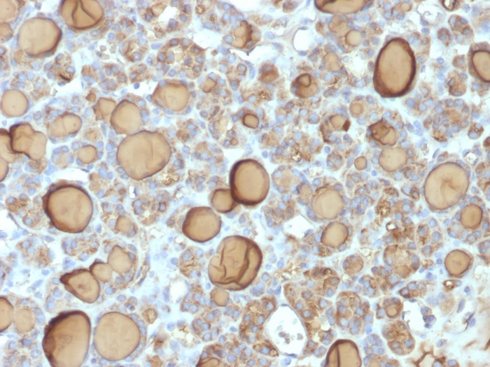 Anti-Thyroglobulin Antibody [TGB/1970R]