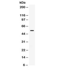 Western blot testing of human HeLa cell lysate with TGFBR1 antibody. Expected/observed molecular weight ~55 kDa.