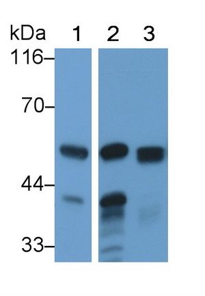 Western Blot; Sample: Lane1: Rat Pancreas lysate; Lane2: Mouse Pancreas lysate; Lane3: Porcine Pancreas lysate<br/>Primary Ab: 0.001µg/ml Rabbit Anti-Human AMY2A Antibody<br/>Second Ab: 0.2µg/mL HRP-Linked Caprine Anti-Rabbit IgG Polyclonal Antibody<br/>(Catalog: SAA544Rb19)