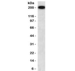 Western blot testing of human brain lysate with recombinant NF-H antibody (clone NFHP-1R). Expected molecular weight ~200 kDa.