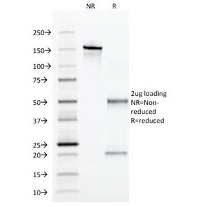 SDS-PAGE Analysis of Purified, BSA-Free Alpha 1 Antitrypsin Antibody (clone AAT/1379). Confirmation of Integrity and Purity of the Antibody.