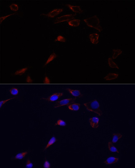 Anti-ADRA1B Antibody