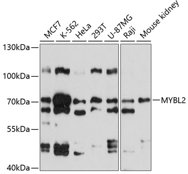 Anti-MYBL2 Antibody