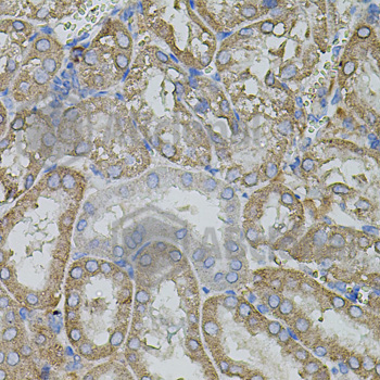 Anti-MMP9 Antibody