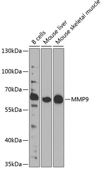 Anti-MMP9 Antibody