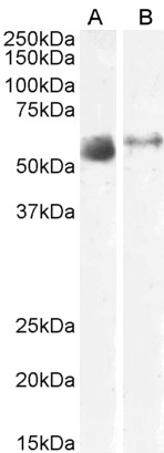 Anti-SLC7A7 Antibody