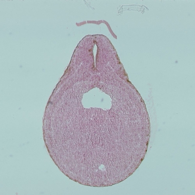 Frog Late Neural Tube, c.s Microscope Slide