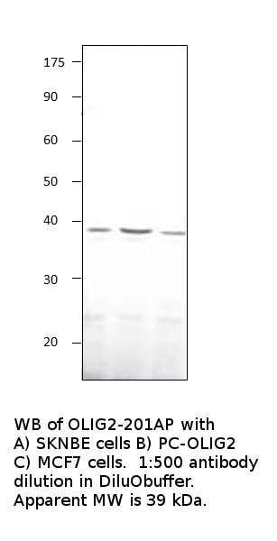 Olig2 Positive Control