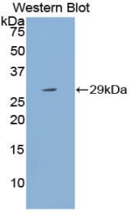 Western Blot; Sample: Recombinant protein.