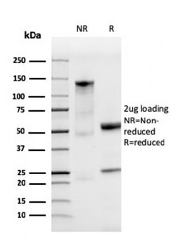 Anti-Ferritin Light Chain Antibody [FTL/3872R] - BSA and Azide free