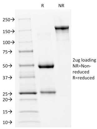 Anti-p53 Antibody [PAb240] - BSA and Azide free