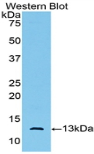 Western Blot; Sample: Recombinant protein.