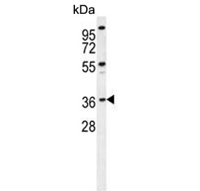 Western blot testing of hamster CHO cell lysate with Exonuclease V antibody. Predicted molecular weight ~42 kDa.