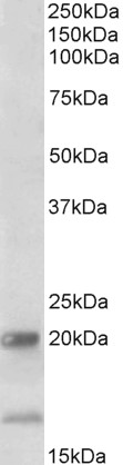 Anti-IL17B Antibody
