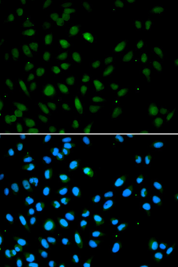 Anti-EZH1 Antibody
