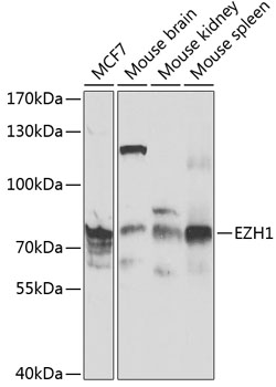 Anti-EZH1 Antibody