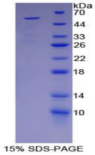 Figure. SDS-PAGE