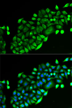 Anti-GSTO2 Antibody