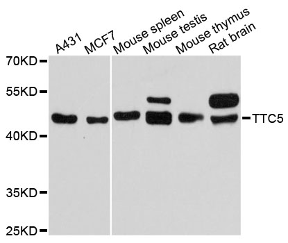 Anti-TTC5 Antibody