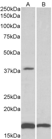Anti-B3GAT1 Antibody