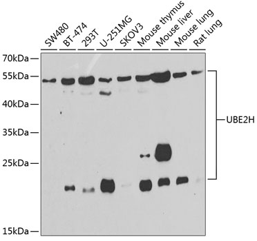 Anti-UBE2H Antibody